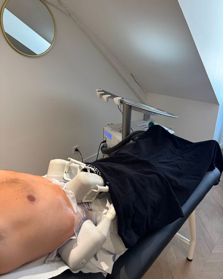 Séance de cryolipolyse
