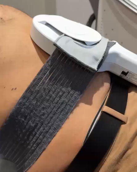 Séance électrostimulation