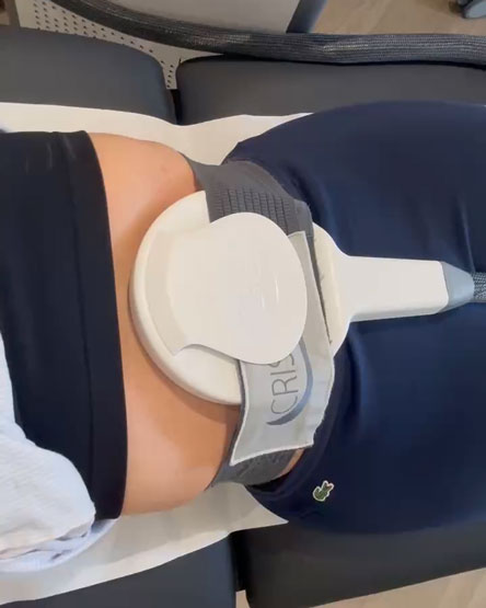 Séance électrostimulation