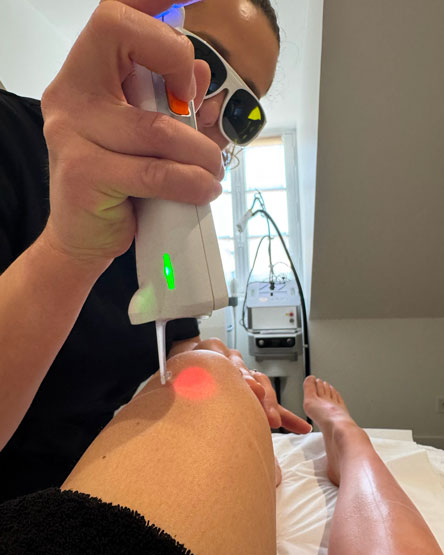 Séance laser épilatoire